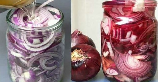 Pickled onions